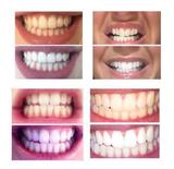 Whitening Toothpaste