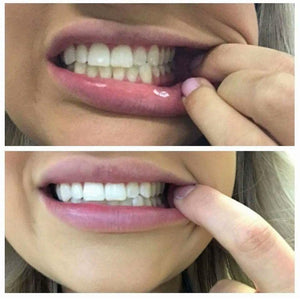 Whitening Toothpaste